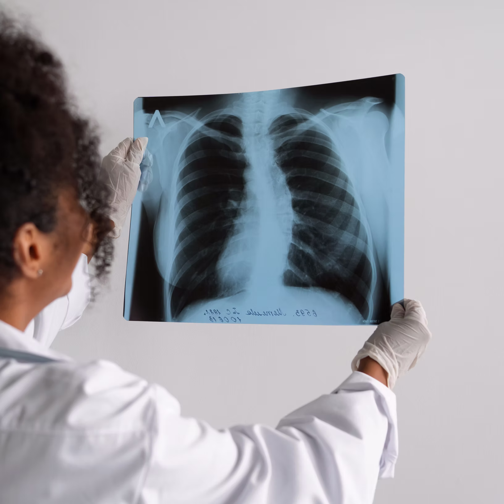 What are the differences between the Wang procedure and the Nuss procedure?