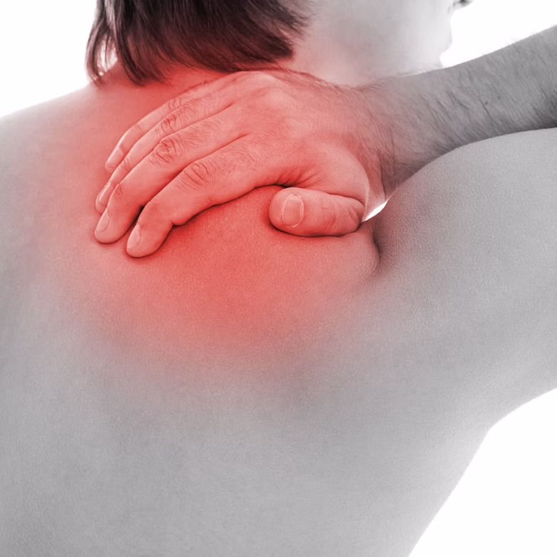 Thoracic outlet syndrome after the Nuss procedure